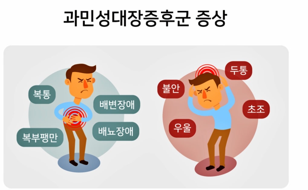 과민성대장증후군-증상