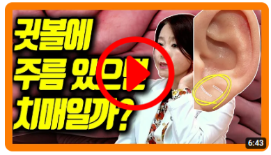 치매 잘 걸리는 사람의 신체적 특징은