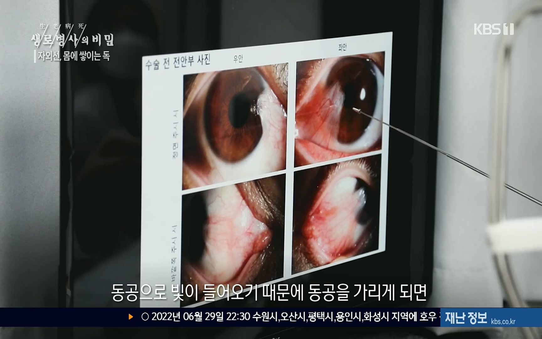 생로병사의 비밀.E824.220629p.H264-F1RST.mp4_20220630_205913.011.jpg