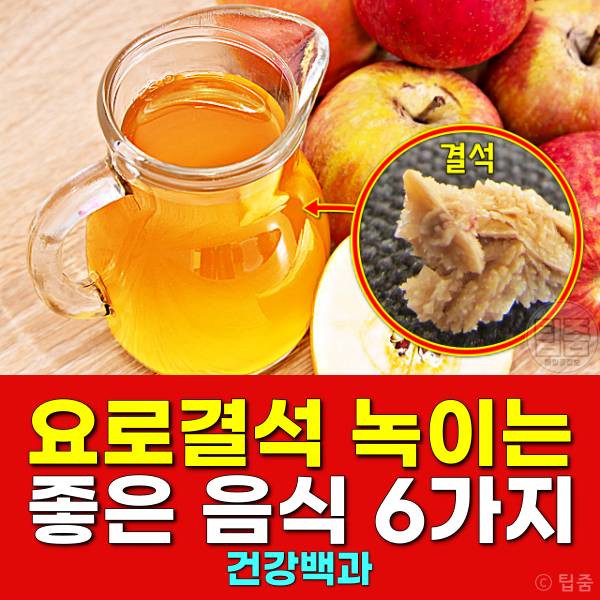 요로결석 녹이는 음식 6가지 | 요로결석 좋은 음식