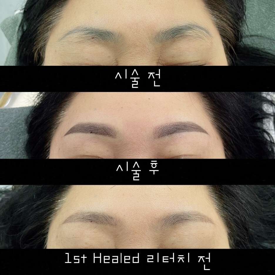  옴브레 탈각후 어떤가요?