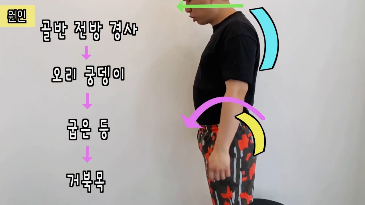 거북목 자세교정방법