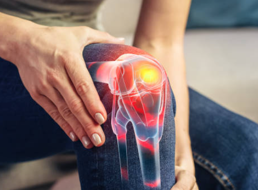 무릎에 물이 차는 증상 물이 찼을때 3