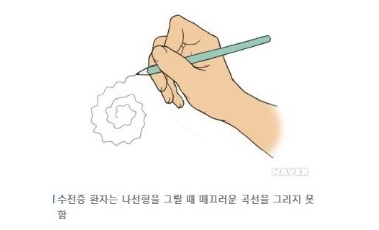 수전증이란? 수전증의 원인 및 4