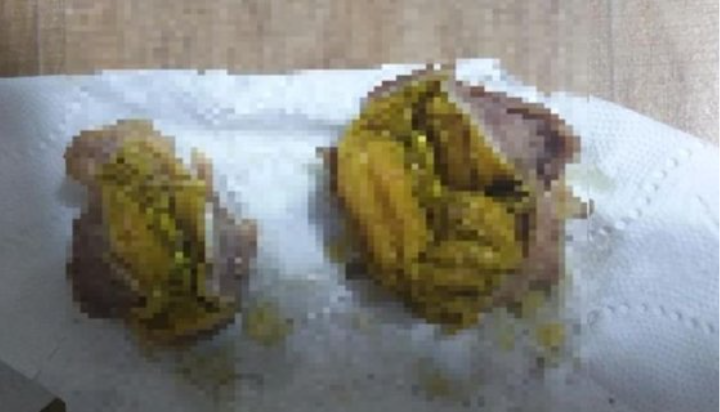 60계치킨썩은맛닭똥집논란사과이물질아냐판매중단