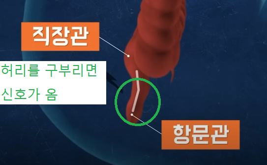 급똥이 발생하는 원인 및 진정 시키고 참는방법