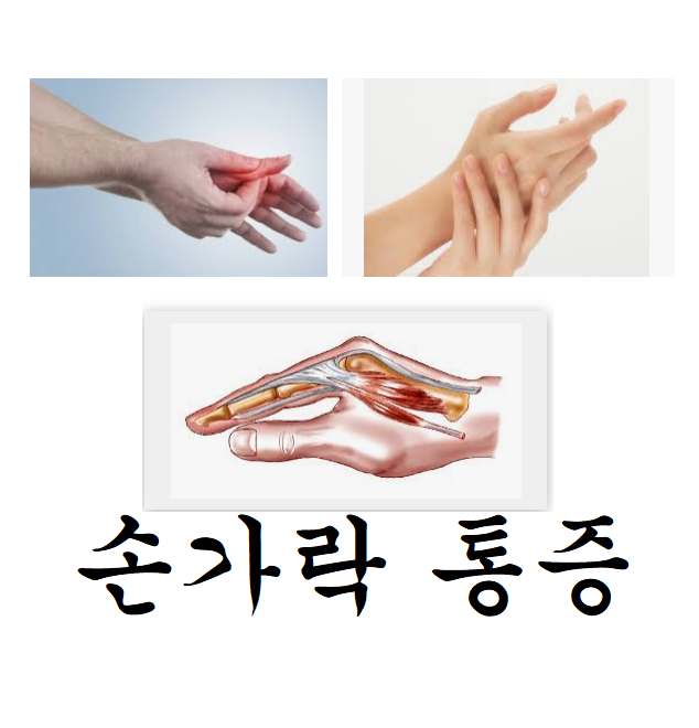  손가락 마디 통증  총정리 (예방법)