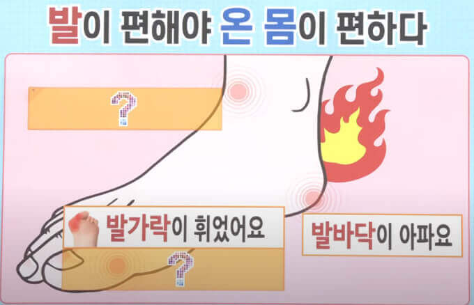  아침 첫발 발바닥이 아픈 족저 근막염과 무지 외반증 운동