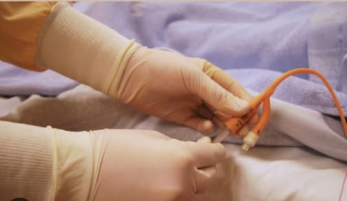 혈관 진입 미니 로봇&#44; 수술 완료!(한양대팀) VIDEO: Small Magnetic Robot Completes Vascular Surgery