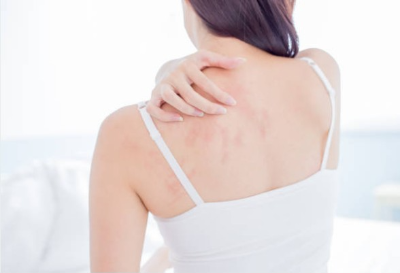 환절기 피부 가려움 원인 및 증상과 관리 팁