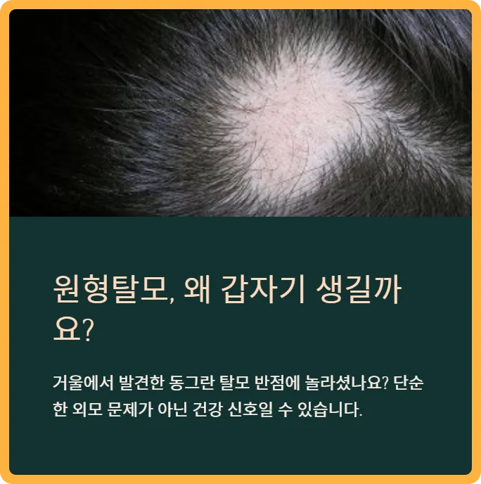 원형탈모-썸네일