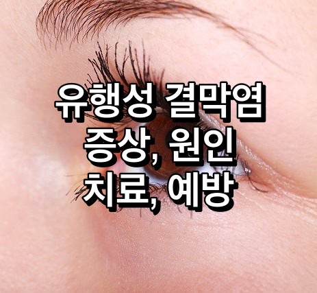 유행성-결막염-증상-원인-치료-예방법