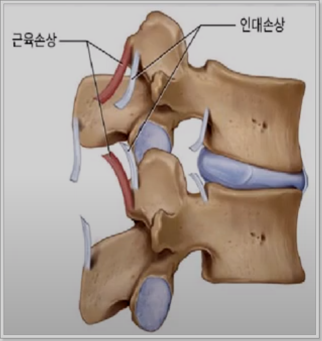 디스크