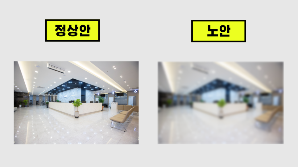  청주노안교정백내장, 노안 자가 진단 테스트