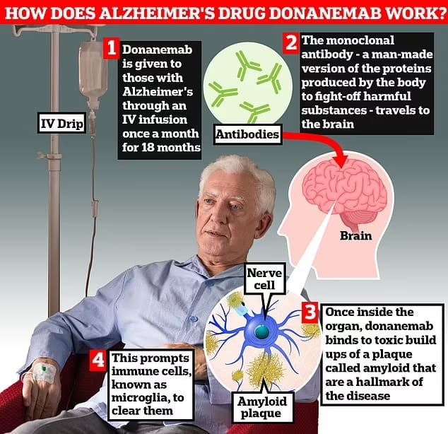 신약 &#39;도나네맙(Donanemab)&#39;&#44; 치매에 효과 입증 Drug donanemab seen as turning point in dementia fight