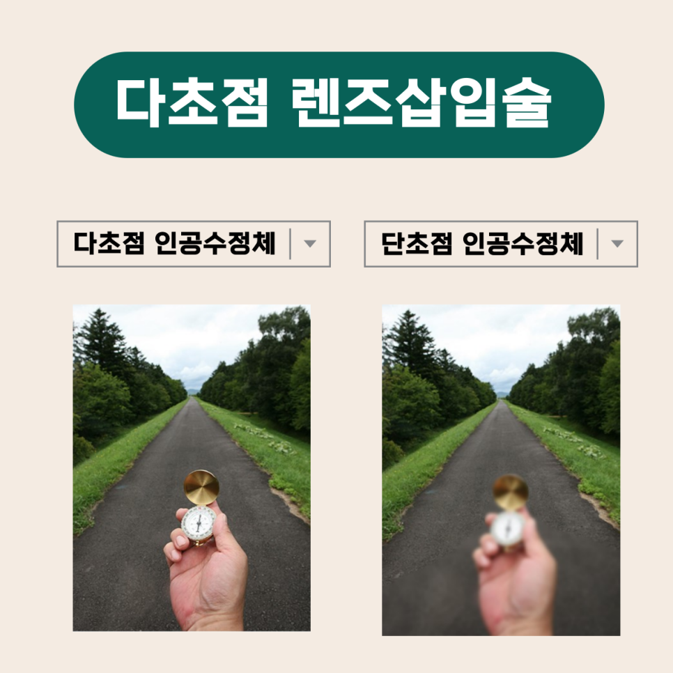  청주안과잘하는곳, 백내장 노안 동시해결!