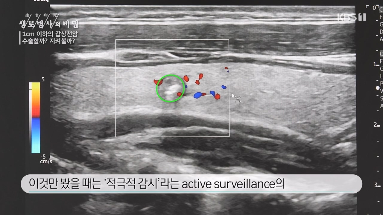 생로병사의 비밀.E894.231228p-NEXT.mp4_20231228_193934.791.jpg