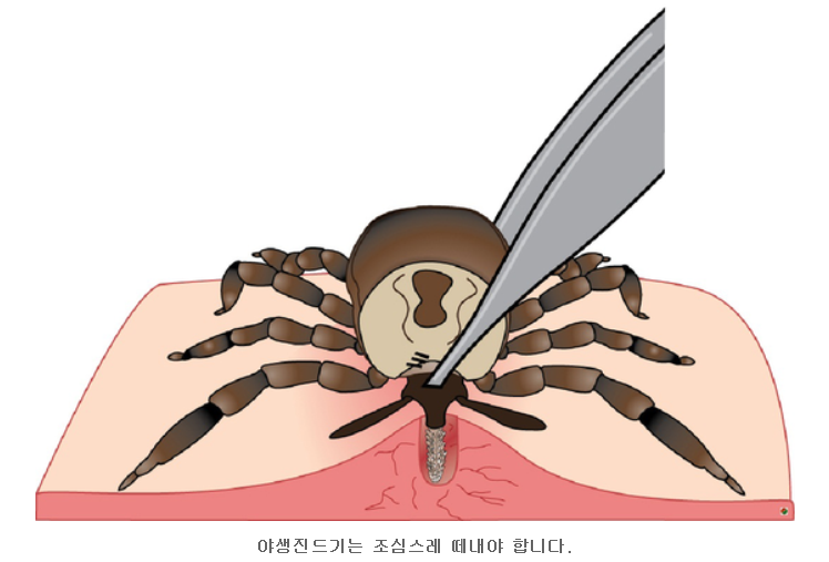  야생진드기 물렸을때 증상/물린자국/감염증상