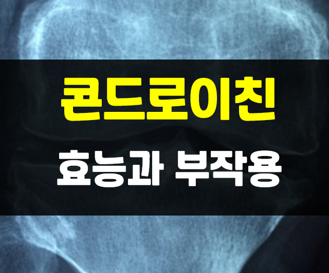  콘드로이친 효능 : 특히 관절과 이것에 최고