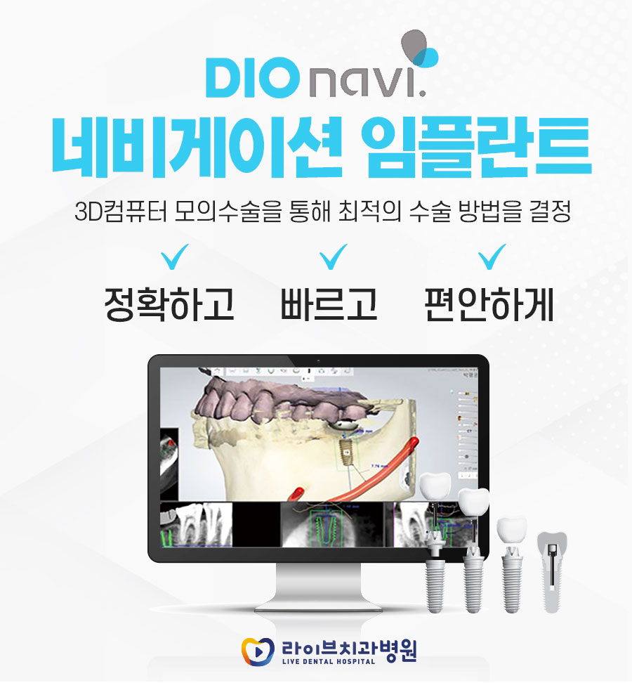 강남역임플란트