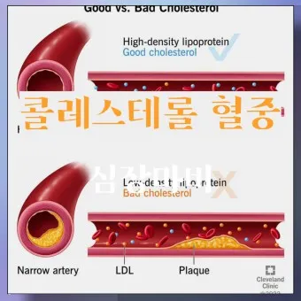 총콜레스테롤 이란 정상수치 낮추는법_9