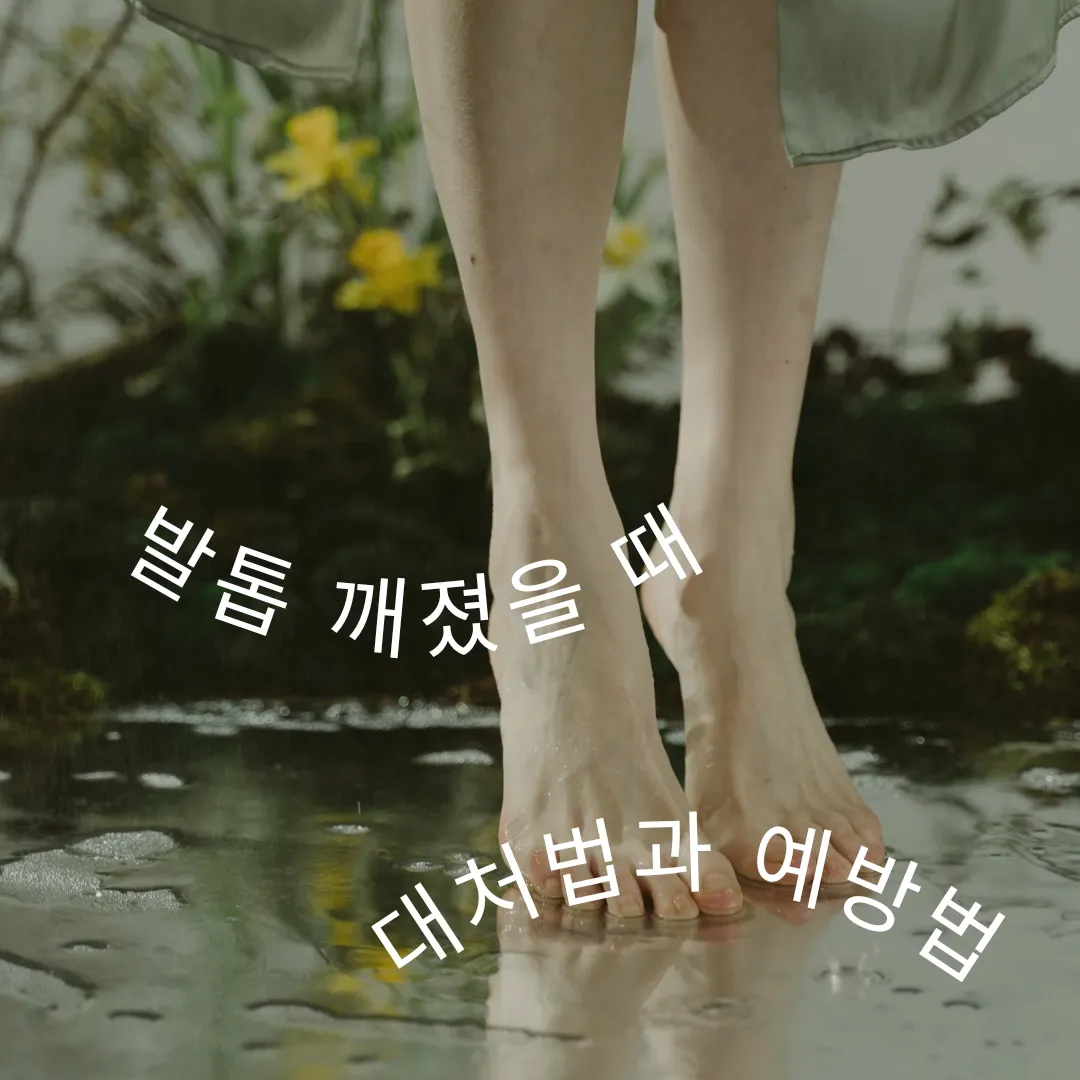  발톱 깨졌을 때 대처법과 예방법