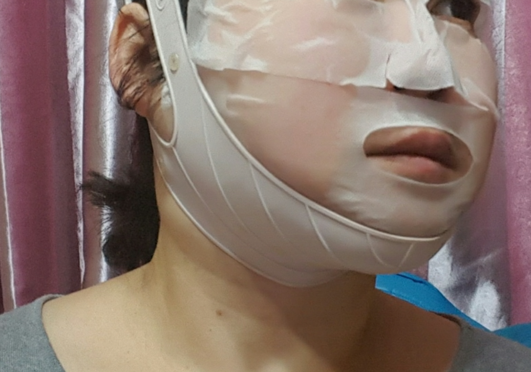 약손명가 리프팅밴드 내돈내산 후기