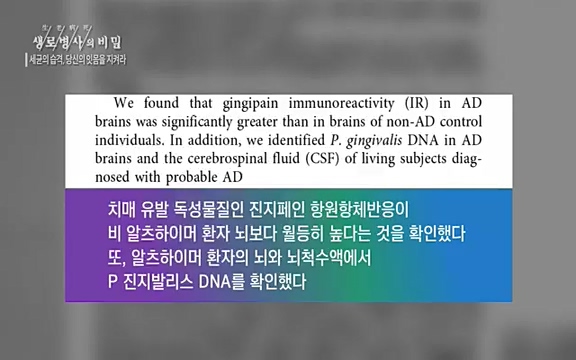[792회] 생로병사의 비밀 - KBS[세균의 습격, 당신의 잇몸을 지켜라!] 감기보다 병원을 더 자주 찾게 만드는 질병이 있다. 바로 치주질환이다. 2020년 외래 다빈도 질병 1위를 차지한 치은염 및 치주질환 환자는 1,637_20220505_140906.765.jpg
