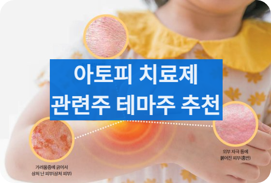 아토피치료제추천