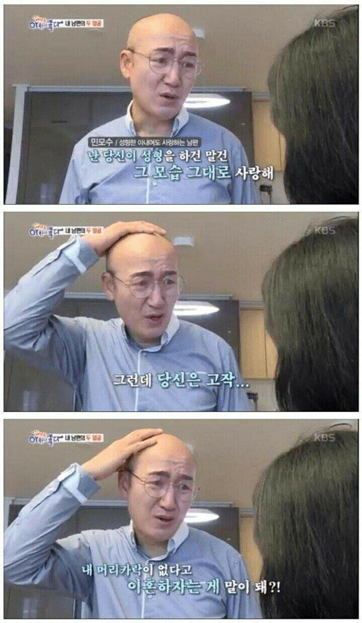  대머리는 이혼사유,,,? ㅠ