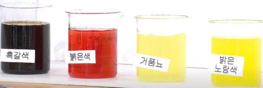  콩팥(신장)의 역할과 만성질환, 소변으로 본 콩팥의 건강