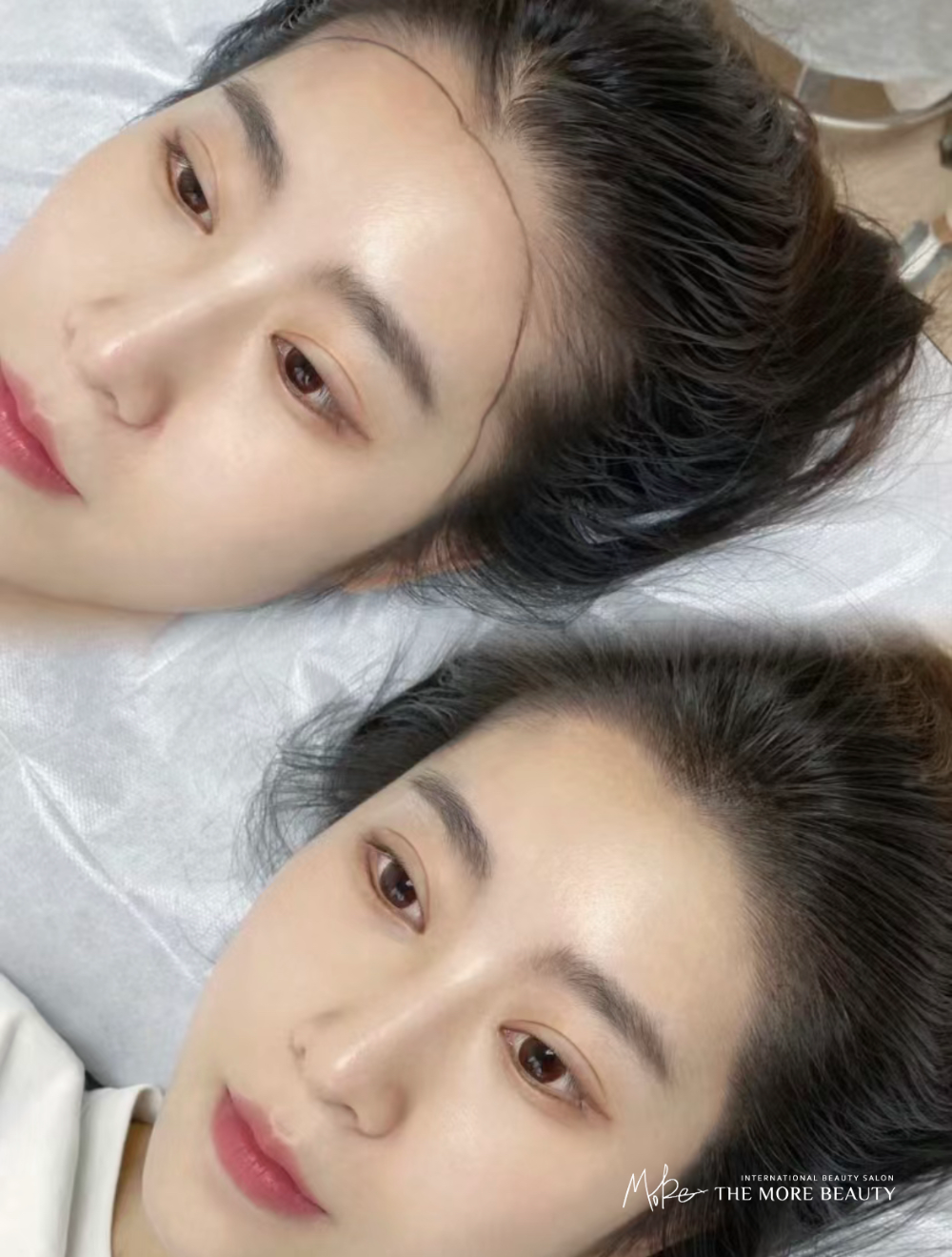 이미지헤어라인 이미지