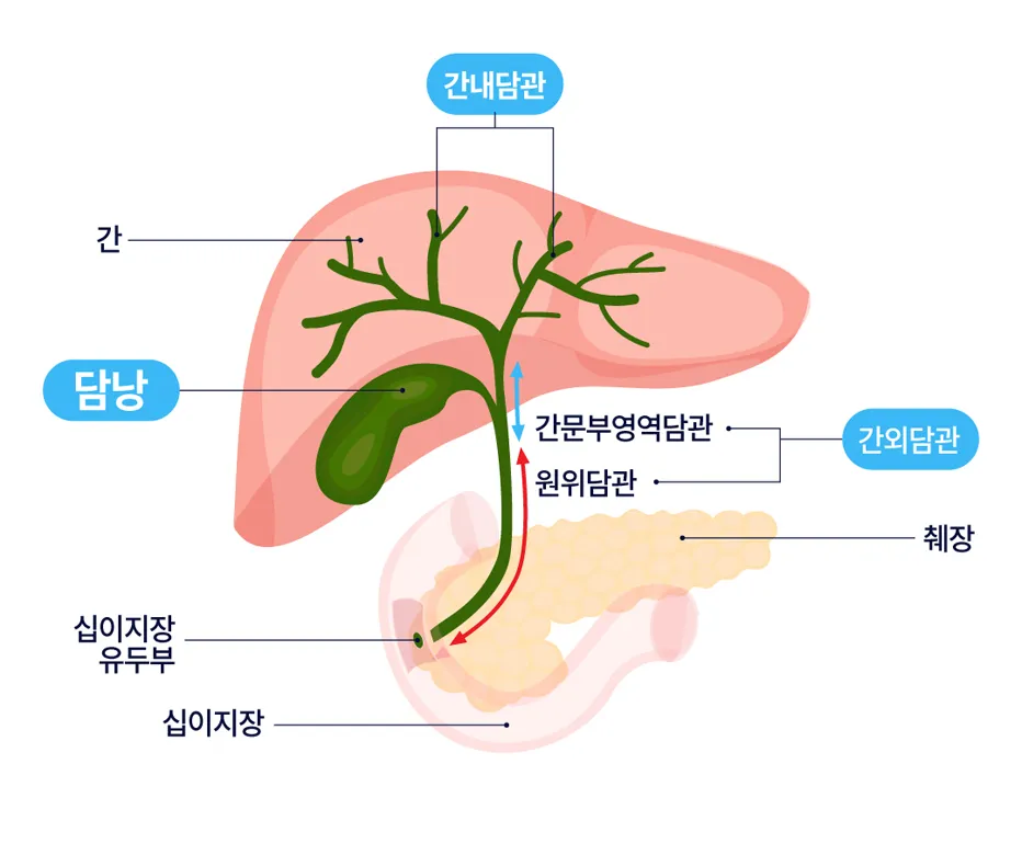 담낭 제거 수술후 먹지말아야할 음식