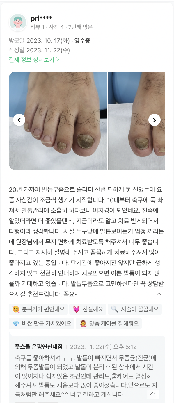축구-무좀-발톱-고객-후기