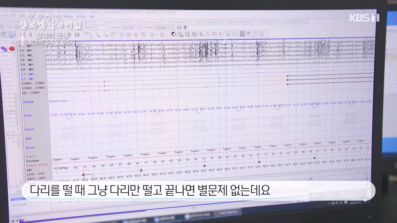 생로병사의 비밀.E880.230824p-NEXT.mp4_20230824_205223.503.jpg