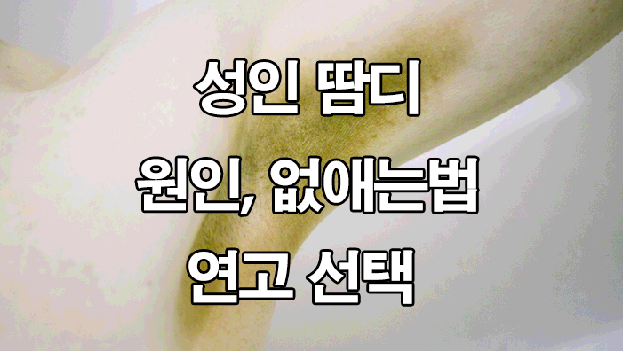  성인 겨드랑이 땀띠 원인 및 없애는법 : 연고 선택