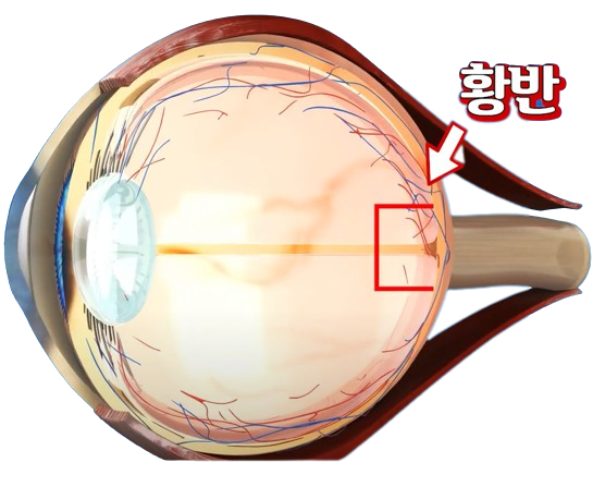 황방의 위치를 나타내는 사진 안구 최중심부에 위치함