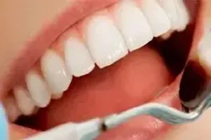 치아