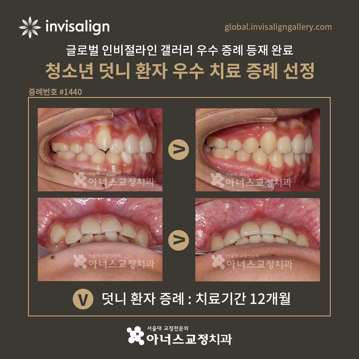 갤러리Q 이미지