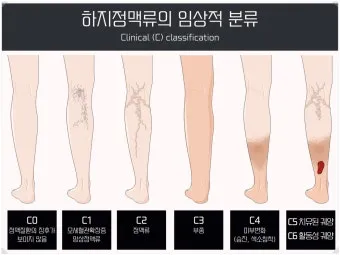 하지 날짜 24절기 망종 소서 전통음식까지_20