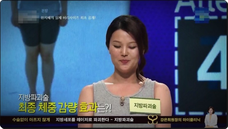 셀룰라이트 제거까지 지방파괴술 효과, 뱃살 다이어트부터 복부 21