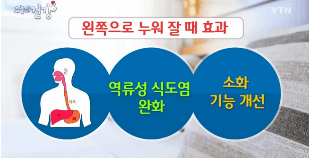 역류성 식도염 원인과 치료법