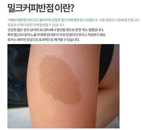 밀크커피 반점(카페오레 반점)