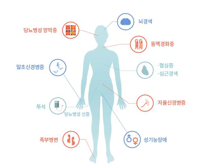 당뇨병 합병증