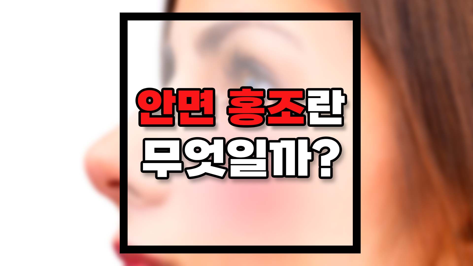  안면홍조란 무엇이고 어떻게 치료해야할까?