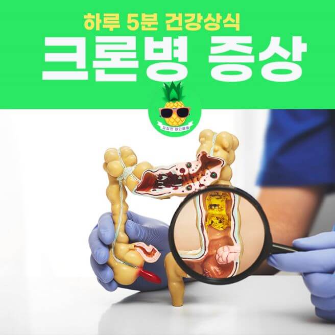 크론병 증상