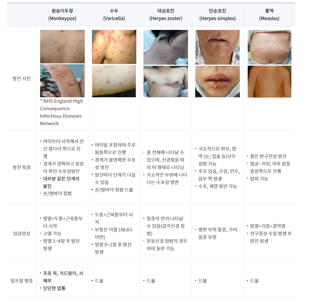 mfox-monkey pox-치료-원인-예방-백신-질문-증상