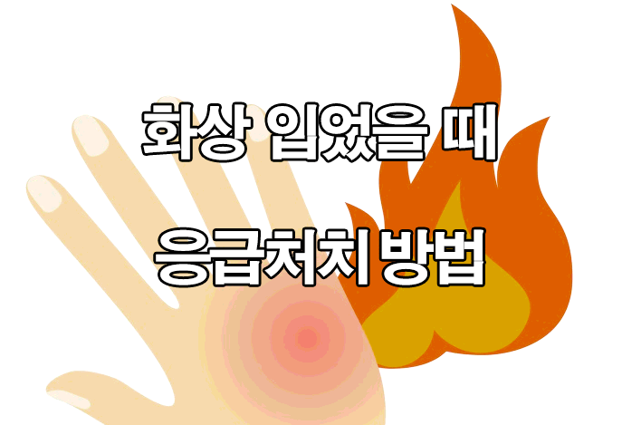 화상 입었을때 응급처치 방법 정리 : 1도, 2도, 3도, 4도