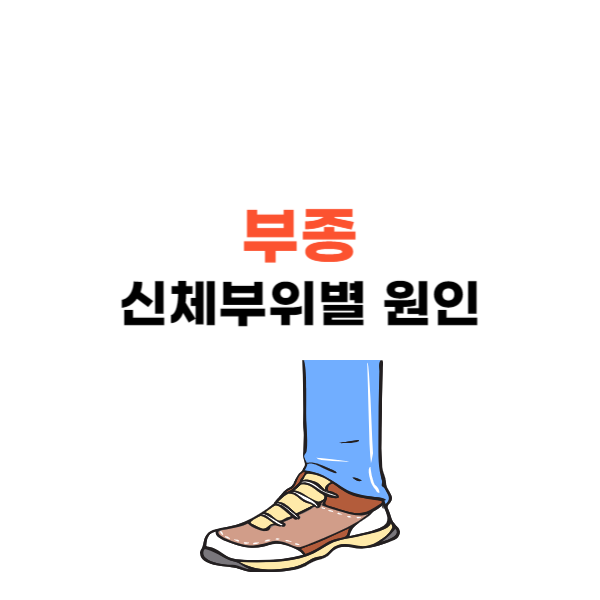 신체 부위별 부종 원인과 빼는법