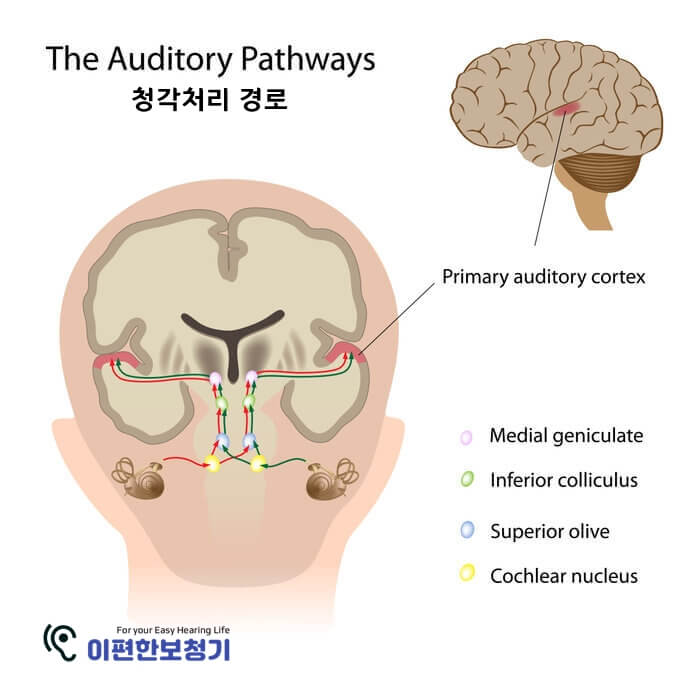  [이편한보청기] 우리는 어떻게 듣는가 : 단계적 설명 (A step-by-step explanation)